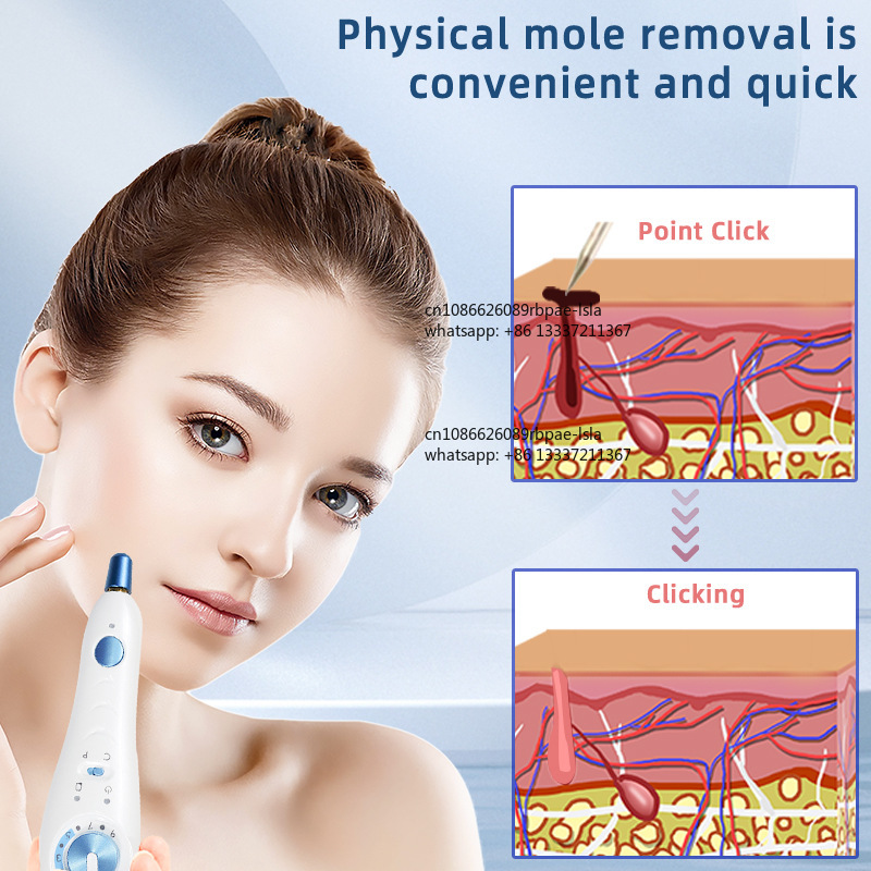 Plasma Pen 500Hz, Pulsador Frí - Plasma Pen Fibroblast Eyelid Lift reseña y precio