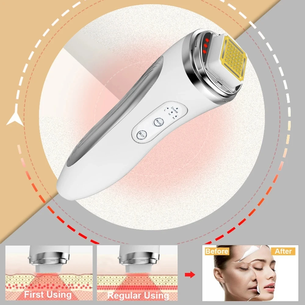 Dispositivo de Radiofrecuencia - Radio Frequency Face Lift Machine reseña y precio