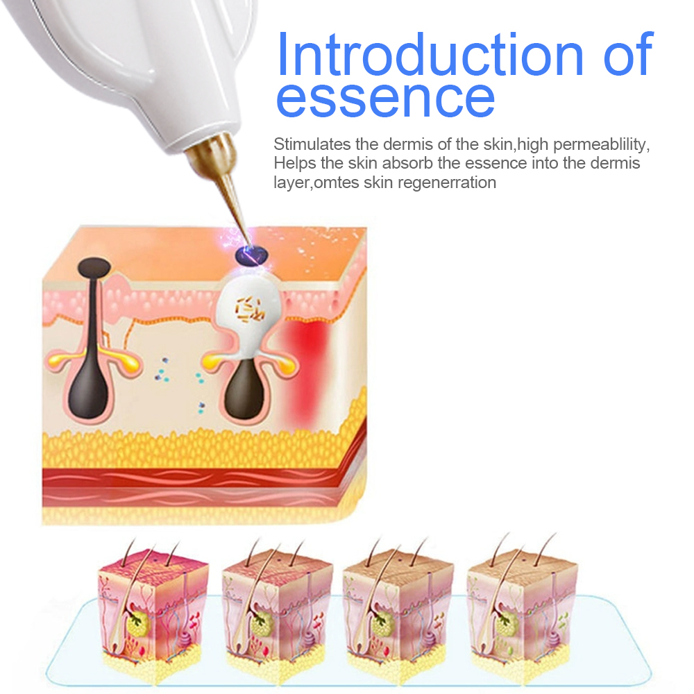 Punta de aguja de repuesto de  - Plasma Pen Fibroblast Eyelid Lift reseña y precio
