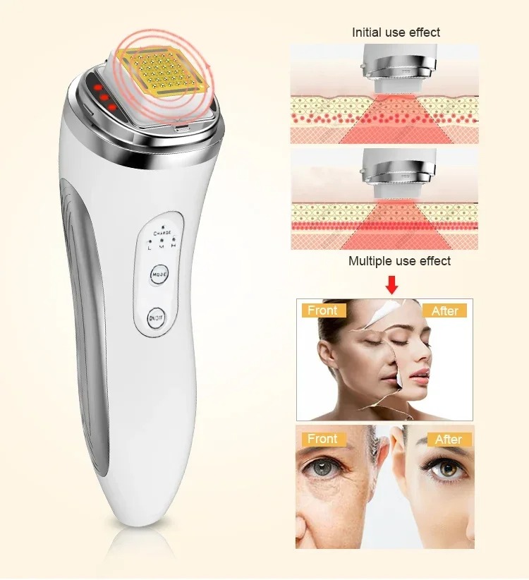 Dispositivo de Estiramiento Fa - Radio Frequency Face Lift Machine reseña y precio